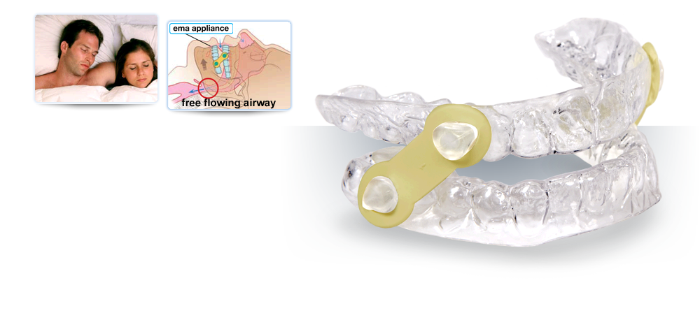 EMA Elastic Mandibular Advancement Appliance To Prevent Snoring